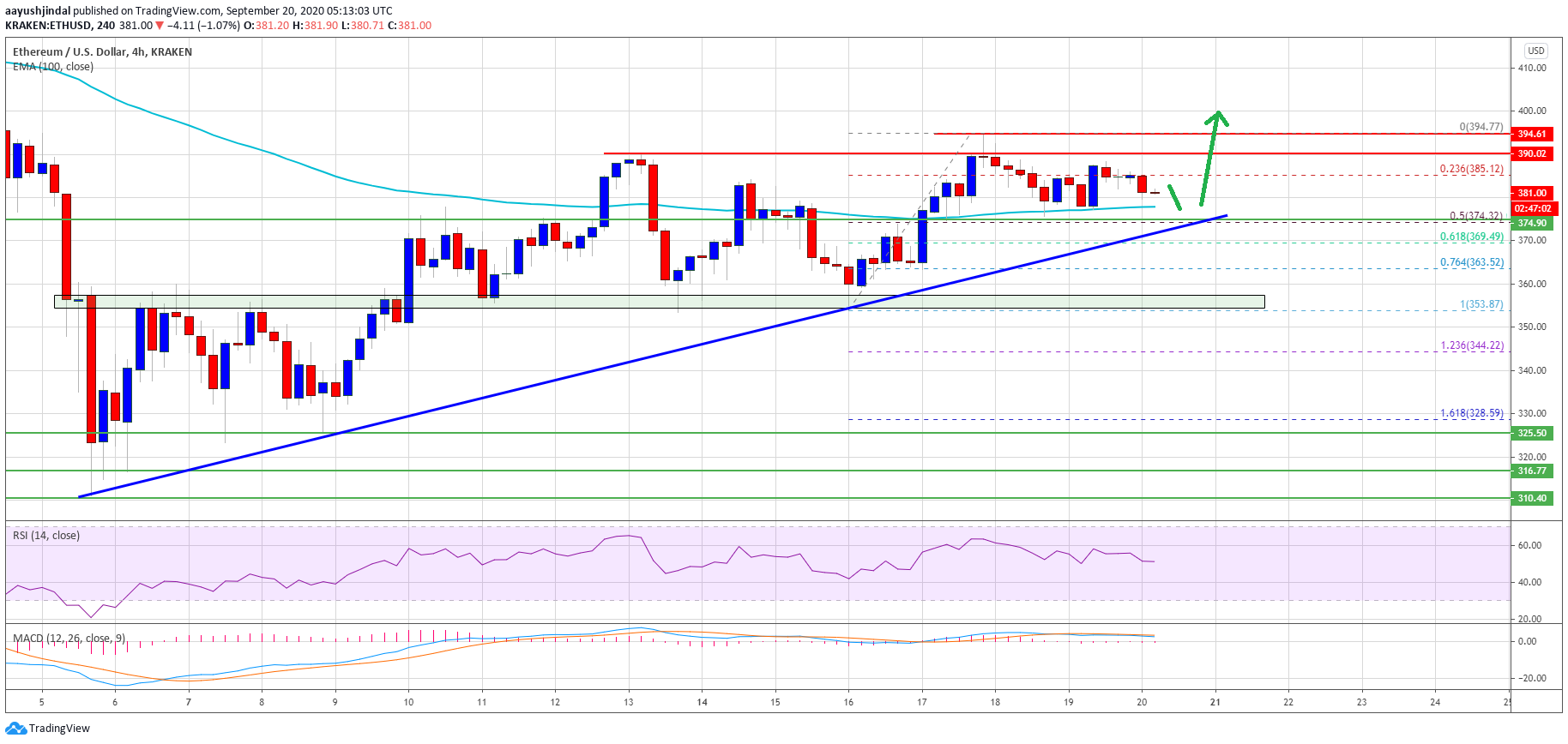 ethereum is struggling near 400 but 100 sma could trigger bullish break